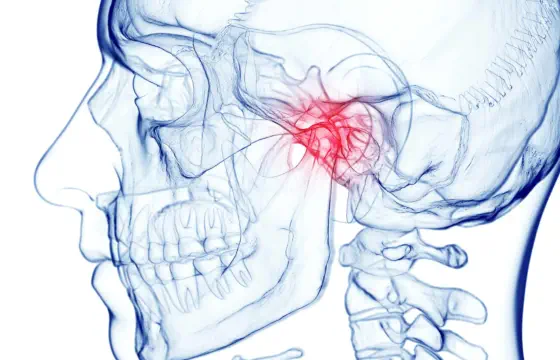 Bruxismo y ATM en Boadilla del Monte