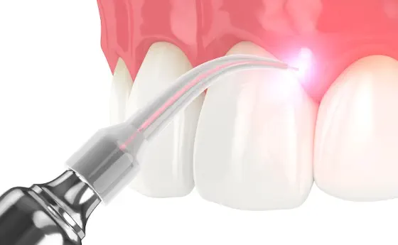 Periodoncia en Boadilla del Monte