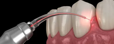 Periodoncia en Boadilla del Monte