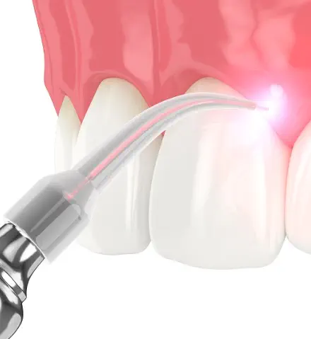 Periodoncia en Boadilla del Monte