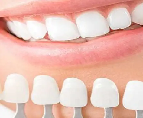 Estética Dental en Boadilla del Monte