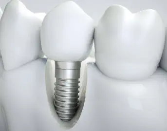 Clinica dental Boadilla del Monte